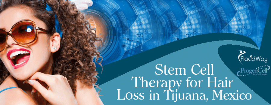 Stem Cell Therapy for Hair Loss in Tijuana, Mexico