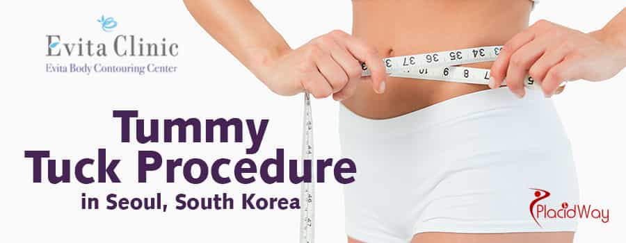 Top Tummy Tuck Procedure in Seoul, South Korea
