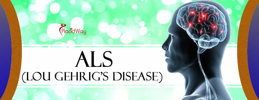 ALS - Lou Gehrig's Disease Treatment Abroad