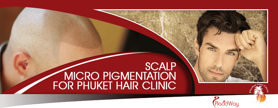 Micro Scalp Pigmentation in Phuket City, Thailand