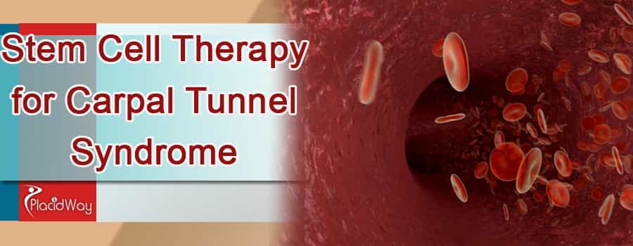 Stem Cell Therapy for Carpal Tunnel Syndrome