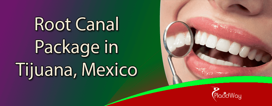Affordable Root Canal Treatment Package in Tijuana, Mexico