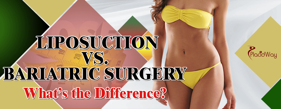 difference-between-bariatric-surgery-liposuction