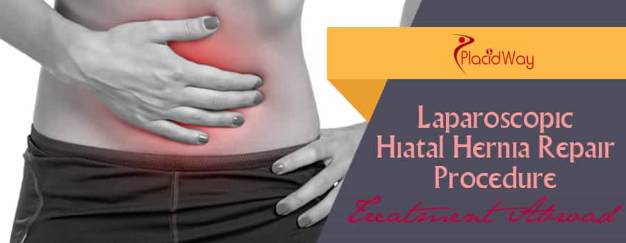 Laparoscopic Hiatal Hernia Repair Procedure Abroad