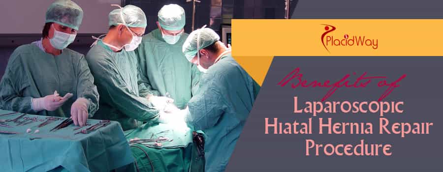 Laparoscopic Hiatal Hernia Repair Procedure Abroad Benefits