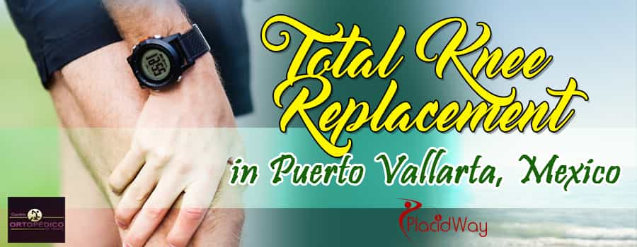 Total Knee Replacement in Puerto Vallarta, Mexico