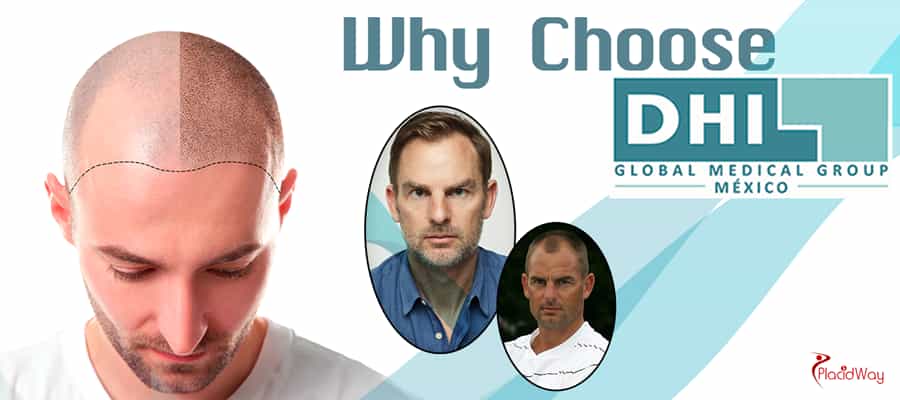 Dhi Mexico Why Choose Dhi Mexico