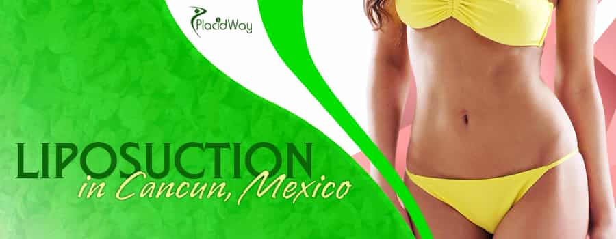 Liposuction in Cancun, Mexico