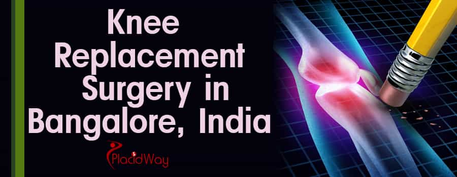 Knee Replacement Surgery in Bangalore