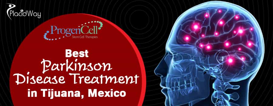 Stem Cell Treatment for Parkinsons Disease Tijuana Mexico