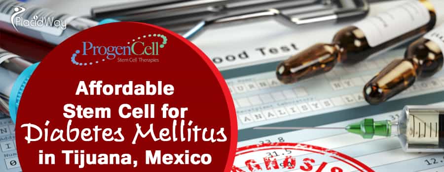 Stem Cell Treatment for Diabetes Mellitus in Mexico