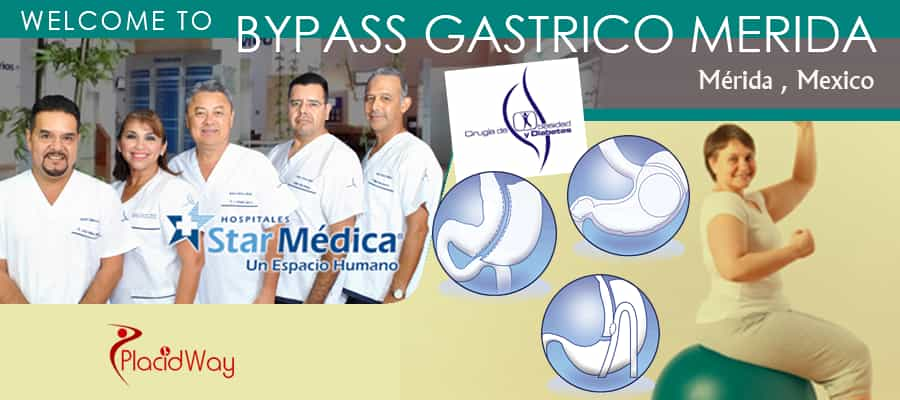 Bypass Gastrico Merida in Yucatan, Mexico 