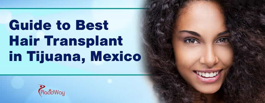 Guide to Best Hair Transplant in Tijuana, Mexico