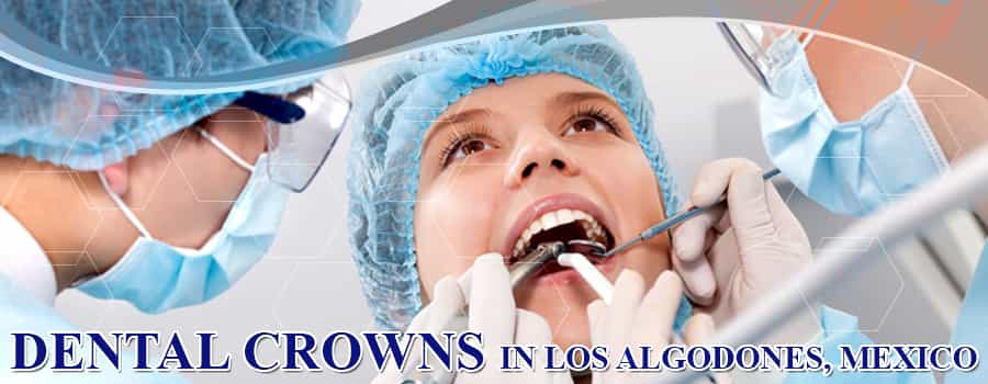Dental Crowns in Los Algodones, Mexico 