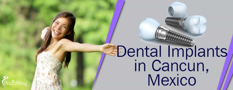 Same-Day Dental Implants in Cancun Mexico