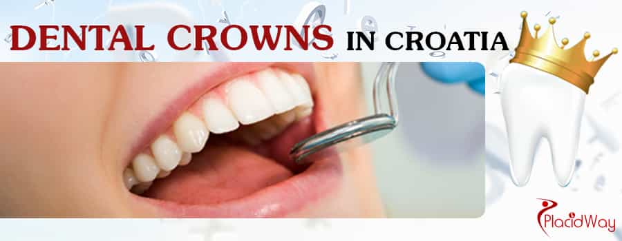 Dental Crowns in Croatia