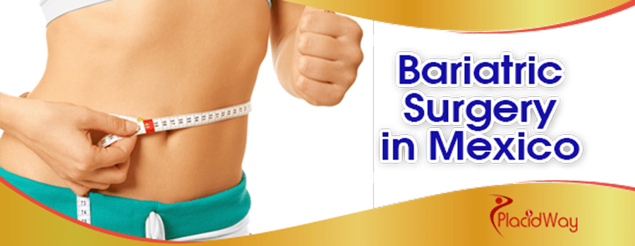 Bariatric Surgery in Mexico Bariatric Surgery in Mexico