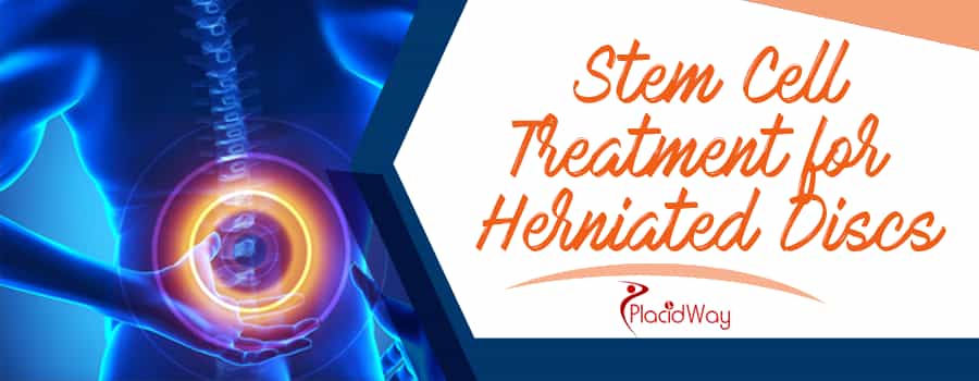 Stem Cell Treatment for a Herniated Disc