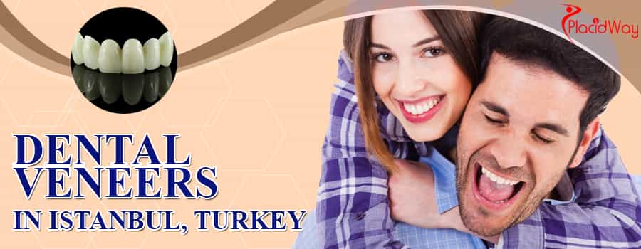 Dental Veneers in Istanbul, Turkey