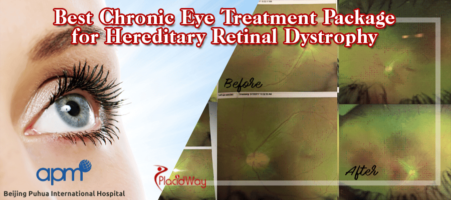 Chronic Eye Treatment Package for Hereditary Retinal Dystrophy