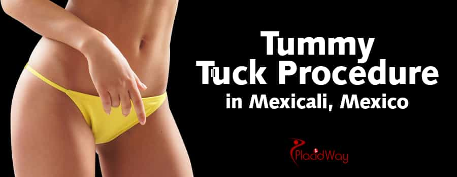 Tummy Tuck in Mexicali, Mexico