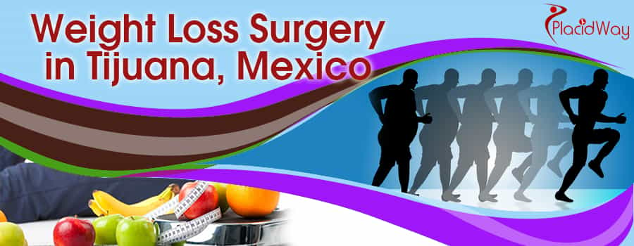 Best Bariatric Surgeons in Tijuana Mexico