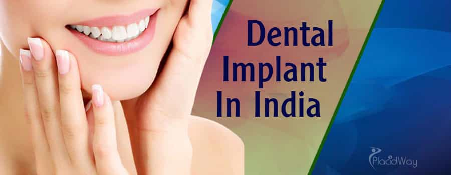 Dental Implants in India