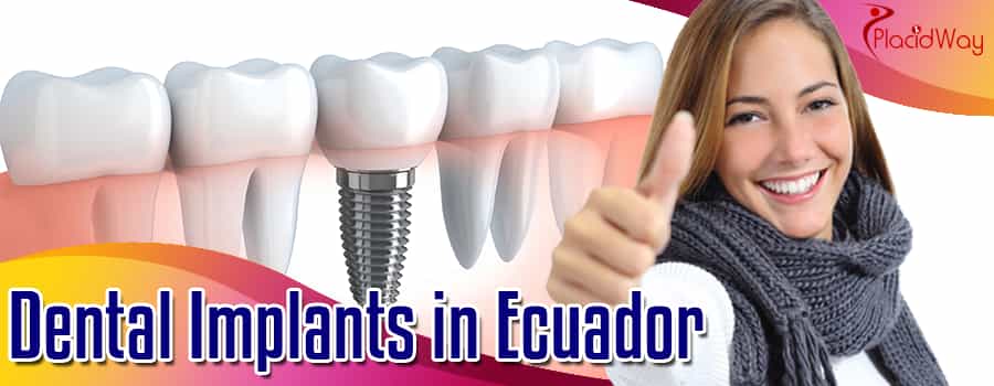Dental Implants in Ecuador