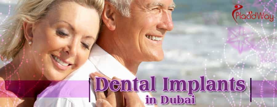 Dental Implants in Dubai