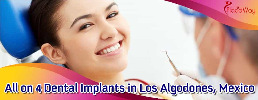 All on 4 Dental Implants in Los Algodonoes, Mexico