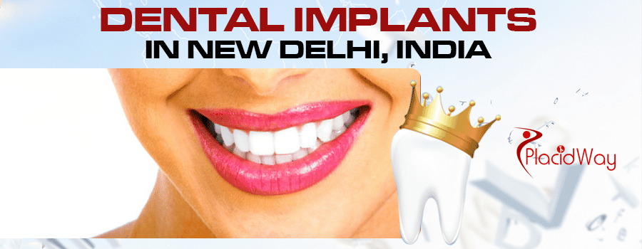 Dental implants in New delhi, India