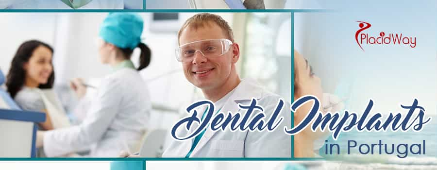 Dental Implants in Portugal