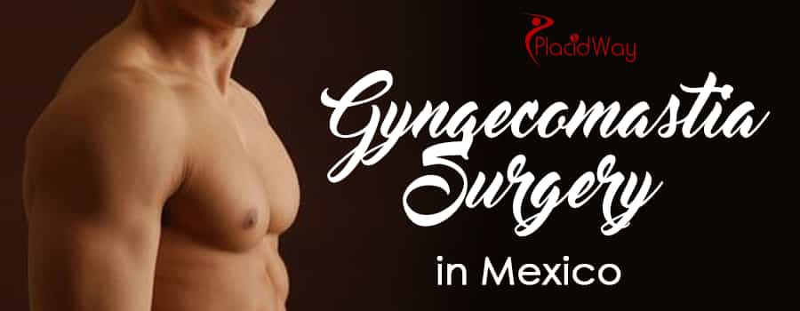 Gynaecomastia Surgery in Mexico