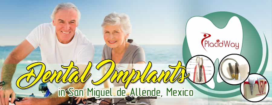 Dental Implants in San Miguel De Allende, Mexico