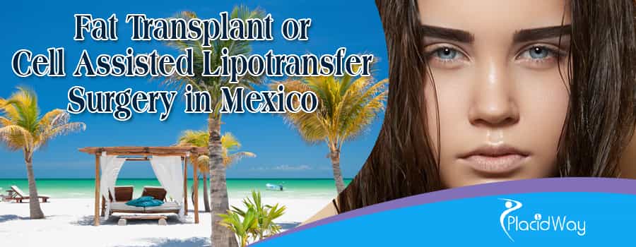 Fat Transplant or Cell Assisted Lipotransfer Surgery in Mexico