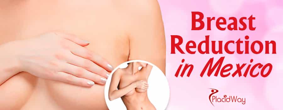 Breast Reduction Surgery in Mexico