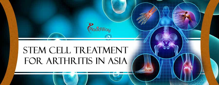 Stem Cell Treatment for Arthritis in Asia