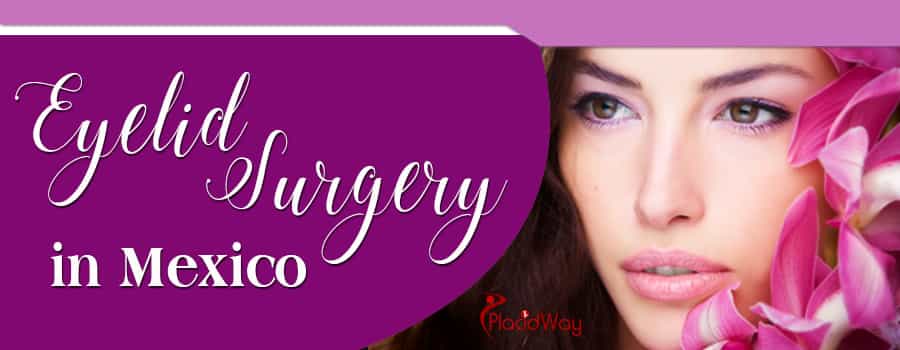 Eyelid Surgery in Mexico