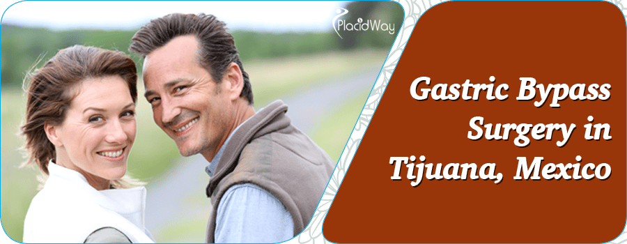 Gastric Bypass Surgery In Tijuana Mexico
