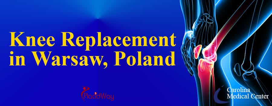 Knee Replacement in Warsaw, Poland