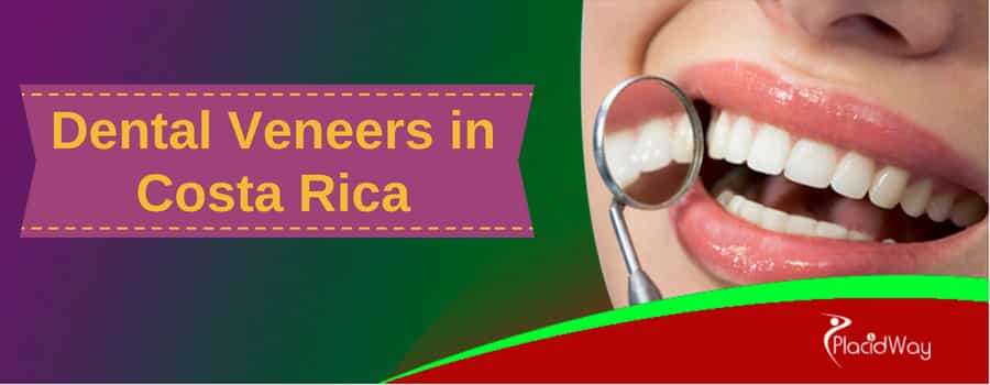 Veneers in Costa Rica A graphic showcasing dental veneers in Costa Rica