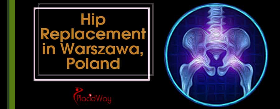 Hip Replacement in Warszawa, Poland