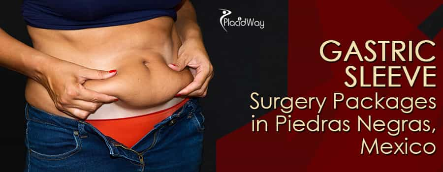 Gastric Sleeve Surgery in Piedras Negras, Mexico