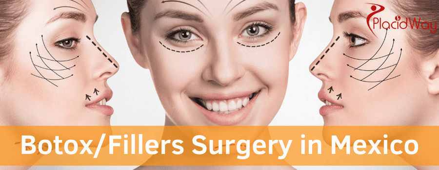 Botox/Fillers Surgery in Mexico