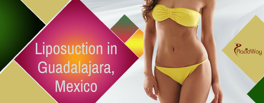 Liposuction in Guadalajara, Mexico