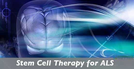 Stem Cell Therapy for ALS in Beijing, China