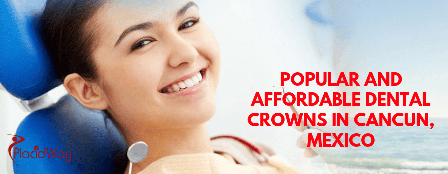 POPULAR AND AFFORDABLE DENTAL CROWNS IN CANCUN, MEXICO