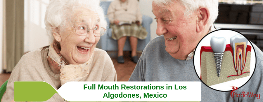 Full Mouth Restorations in Los Algodones, Mexico