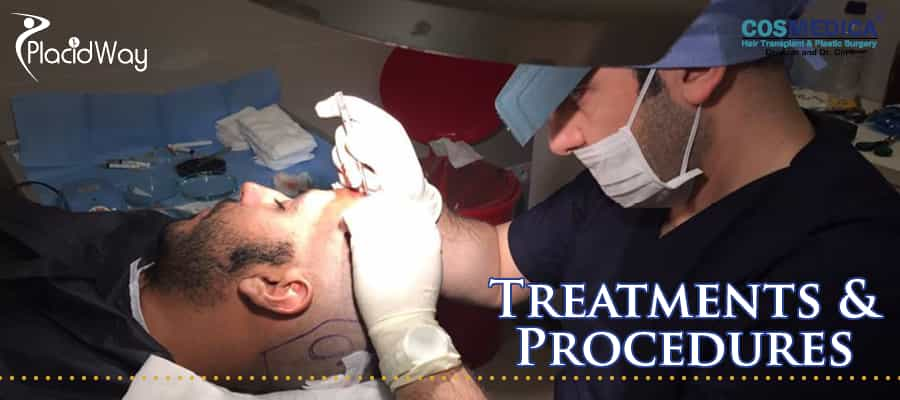 Hair transplantation in Istanbul, Turkey