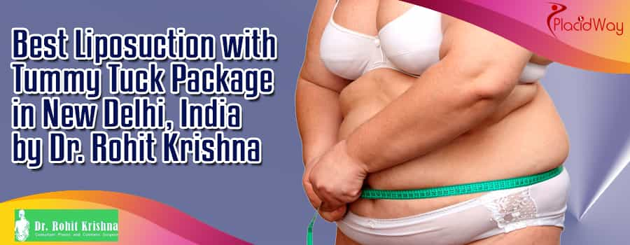 Best Liposuction with Tummy Tuck Package in New Delhi, India by Dr. Rohit Krishna